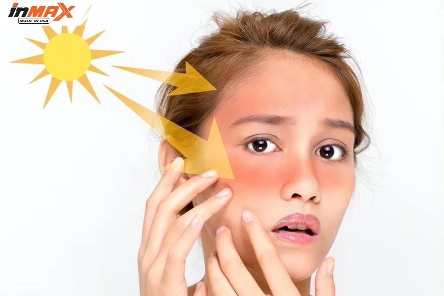 Tia hồng ngoại gây tổn thương da